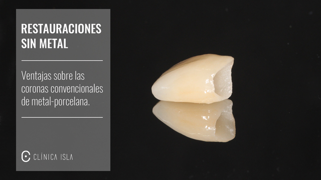 Se introdujeron las restauraciones