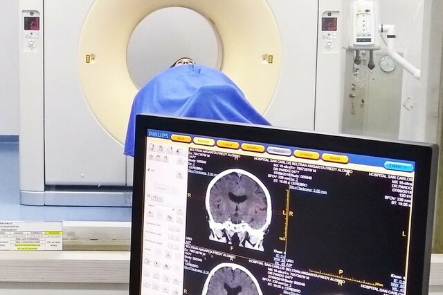 Los Rayos X ( Tomografía Computarizada)