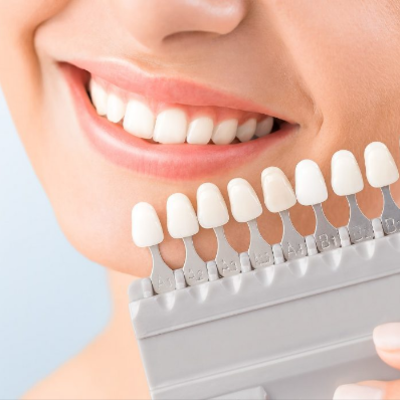 Timeline: Evolución de la Odontología Restauradora