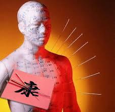 Medicina Tradicional China (Incluye Acupuntura)