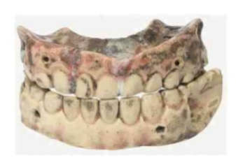 Primer dentadura completa hecha con cerámica