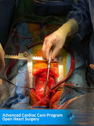 Open heart surgery