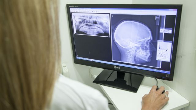 Diagnostico mediante rayos x