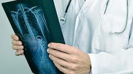 Timeline: Protección Radiológica ( Daniel León )