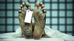 Selmi descubrió las ptomaínas