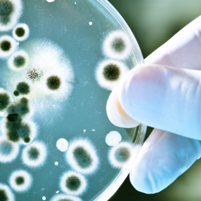 Timeline: Desarrollo histórico de la Microbiología