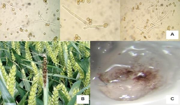 LA TEORÍA MICROBIANA SIN PASTEUR Y KOCH