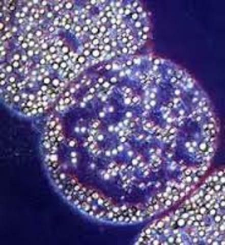 Se descubre la bacteria gigante thiomargarita mamibiensis