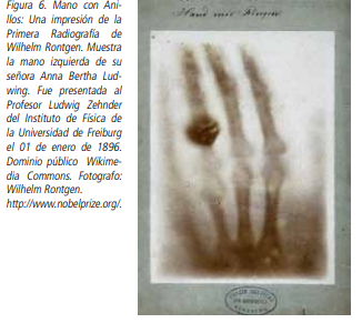 Primera Radiografía