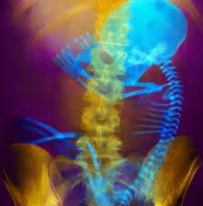 Efectos biológicos de la radiación