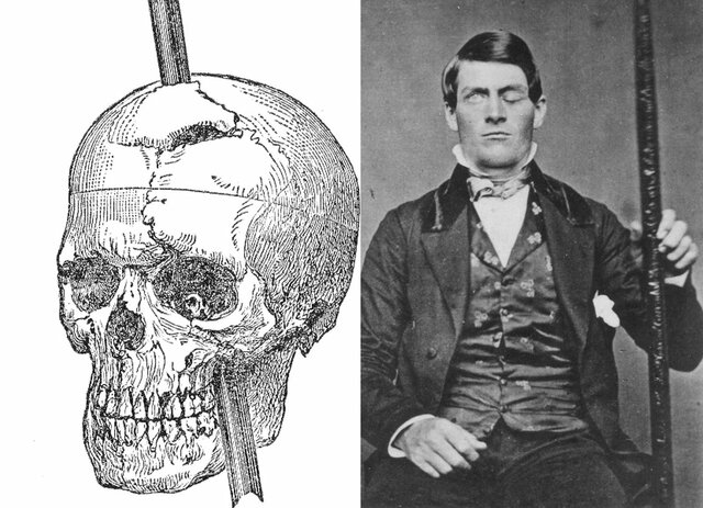 El caso de Phineas Gage