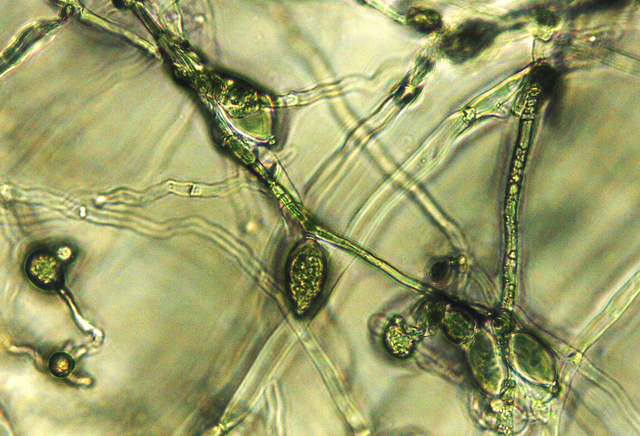 Phytophthora infestans