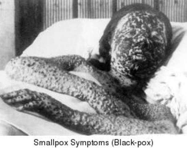 Lipan Apache-Small Pox Outbreak