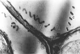 Espiroplasmas en plantas