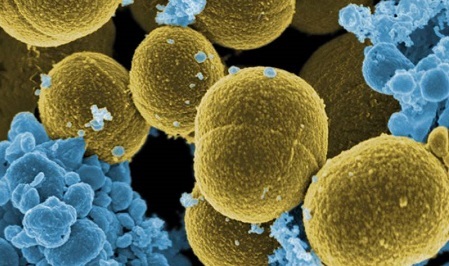 Descubren un mecanismo que regula la actividad patogénica de la bacteria ‘Staphylococcus aureus’