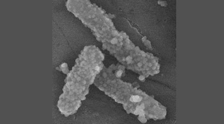 Bacterias para transportar nanopartículas cargadas con fármacos a tejidos tumorales