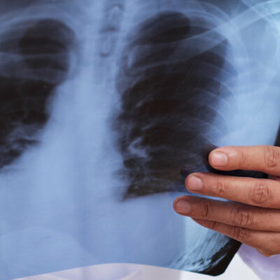 Timeline: Radiologìa Convencional