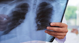 Timeline: Radiologìa Convencional