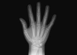 primeras fotografías