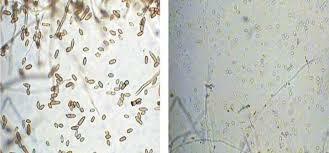 LA TEORÍA MICROBIANA SIN PASTEUR Y KOCH