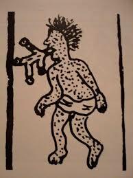 Epidemia de sarampión