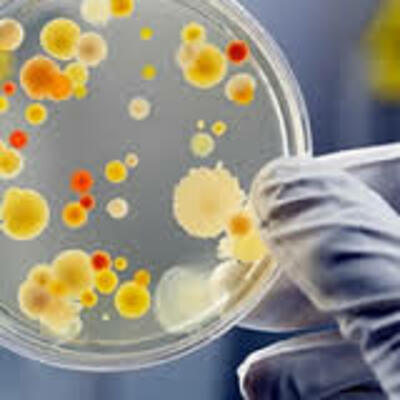 Timeline: Historia de la microbiología