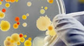 Timeline: Historia de la microbiología