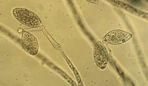 ESPORAS DE HONGOS ( 1807)