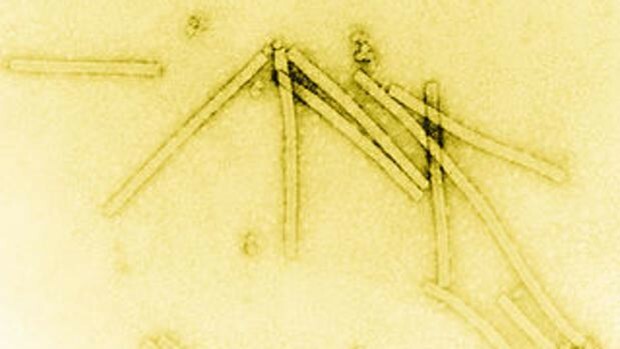 Observación de virus por primera vez