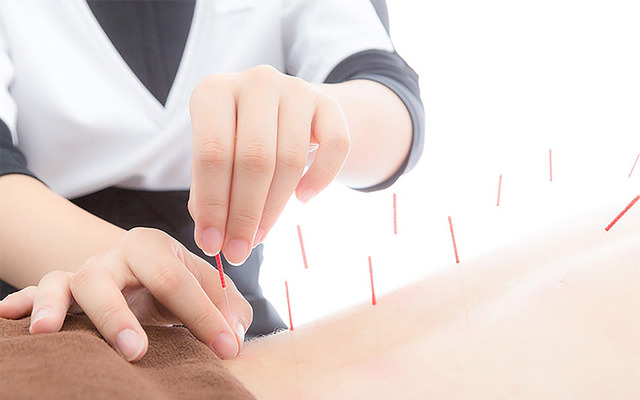 ACUPUNTURA CHINA, MEDICINA ALTERNATIVA