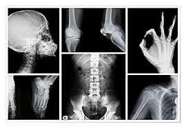 Proteccion radiologica en Colombia