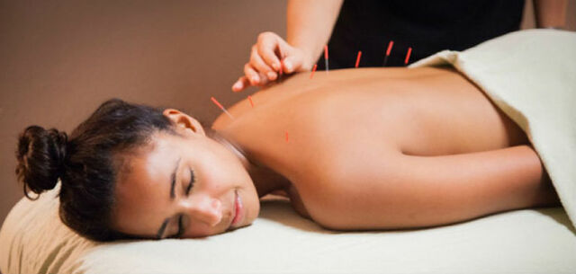 Acupuntura - 100 A.C.
