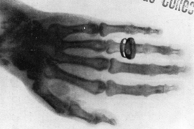 Рентгеновское излучение