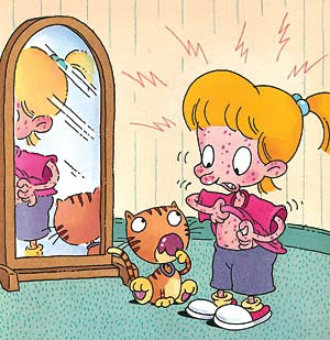 Enfermedad del suero (Hipersensibilidad)