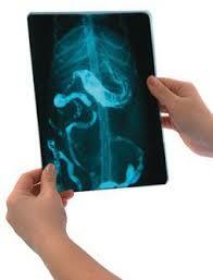 Agentes de contraste intravasculares