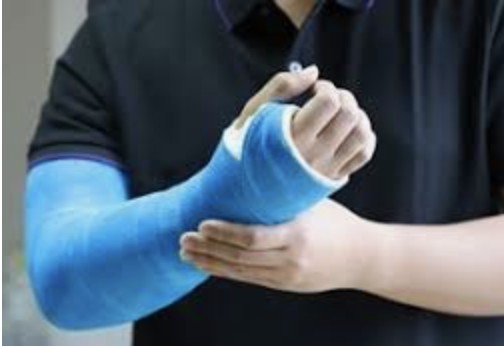 I broke my arm :(