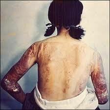 Los rayos X (evento 5)