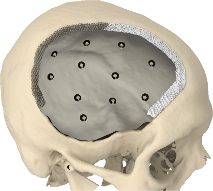 Hallazgos de las tumbas de Paracas