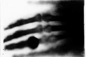 Aplicaciones desde 1895 hasta nuestros días de la radiación ionizante (evento 1)