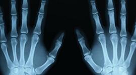 Timeline: Presaberes y Fundamentos,  Angie Vanessa Garcia Diaz