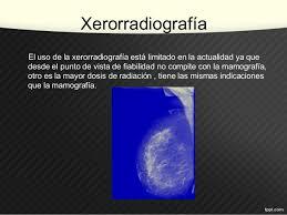 Rayos X evento 5, Xerorradiografía