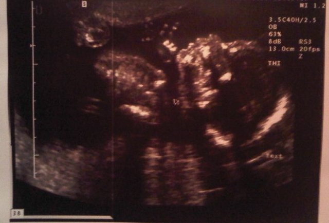 The Birth of the Wonderful Orhay Gewargis