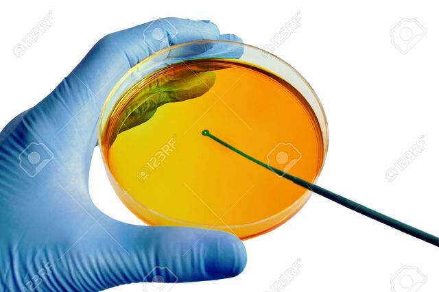 La teoría microbiana sin Pasteur y Koch.