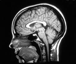 1973 Resonancia Magnética