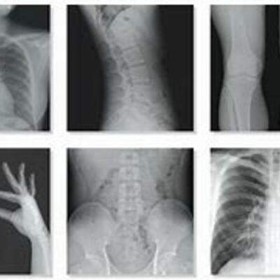 Timeline: Radiobiología y Radioprotección ( presaberes y fundamentos )