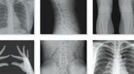 Timeline: Radiobiología y Radioprotección ( presaberes y fundamentos )