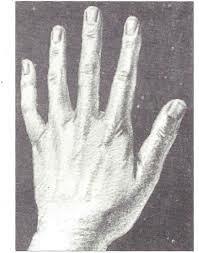 TERAPIAS NATURALES (CURACIÓN POR EL TACTO)