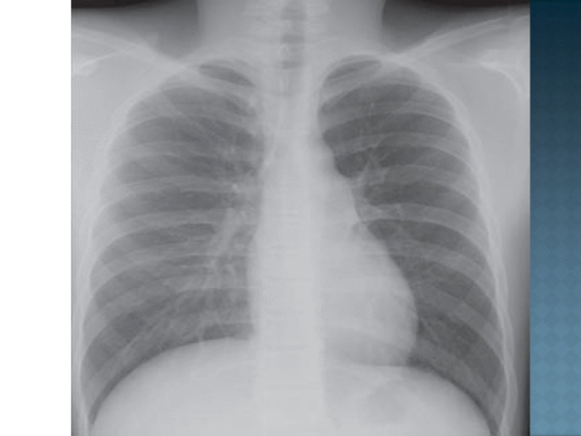 Aplicación de la Radiología al Sistema Oseo