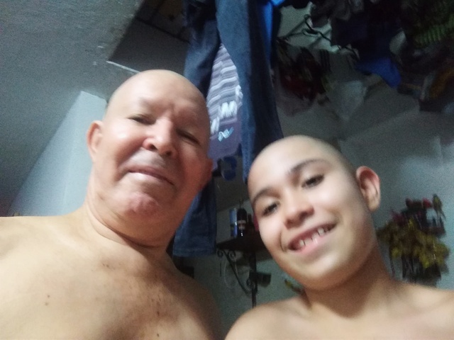 TRASNPLATE DE MEDULA DE MI PAPA