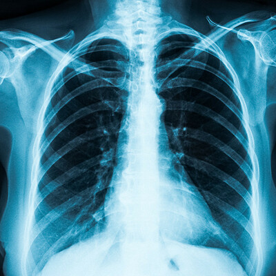 Timeline: PRESABERES Y FUNDAMENTOS